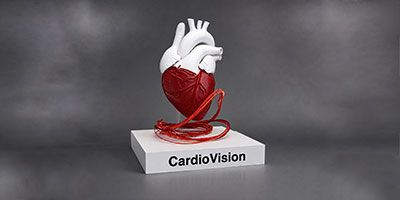 CardioVision — Transforming echo into MRI precision