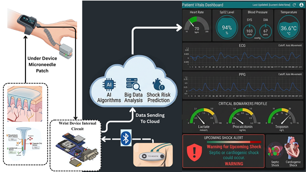 AI Early Detection System for Critical Care Shock
